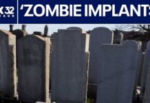 Beauticians Injecting Cadaver-Derived Fat into Patients ‘Zombie filler’ uses cadaver tissue in cosmetic treatments | ChicagoLIVE