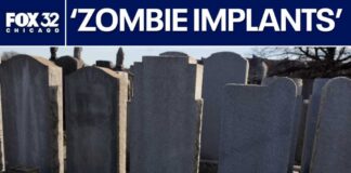 Beauticians Injecting Cadaver-Derived Fat into Patients ‘Zombie filler’ uses cadaver tissue in cosmetic treatments | ChicagoLIVE