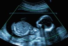 Parents Demand Abortion — Surrogate Fights Back Fetal ultrasound scan image